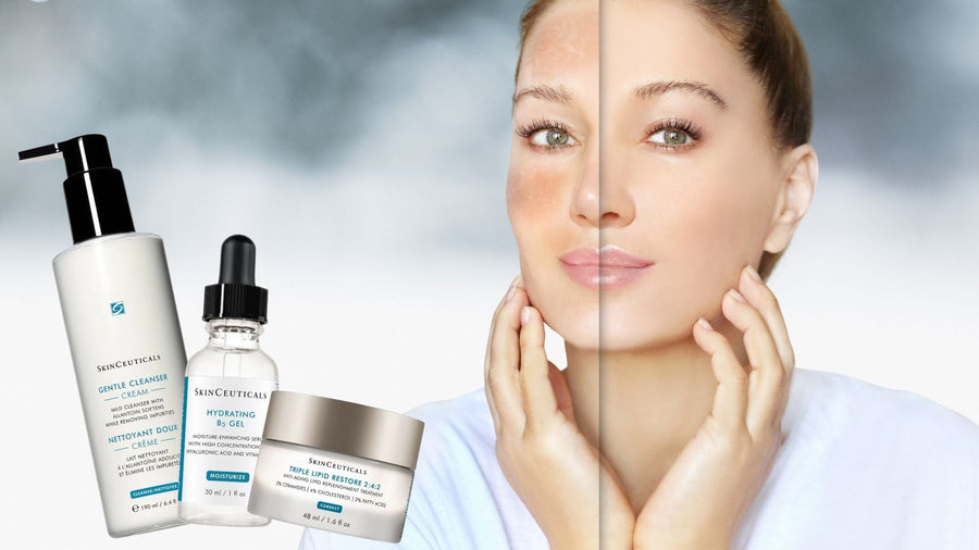 Winter Skin Barrier Repair