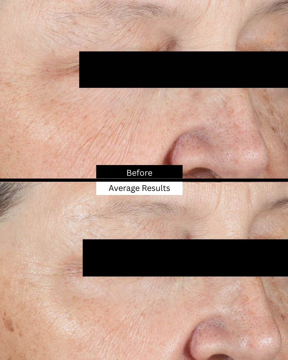 age-eye-cream-before-after