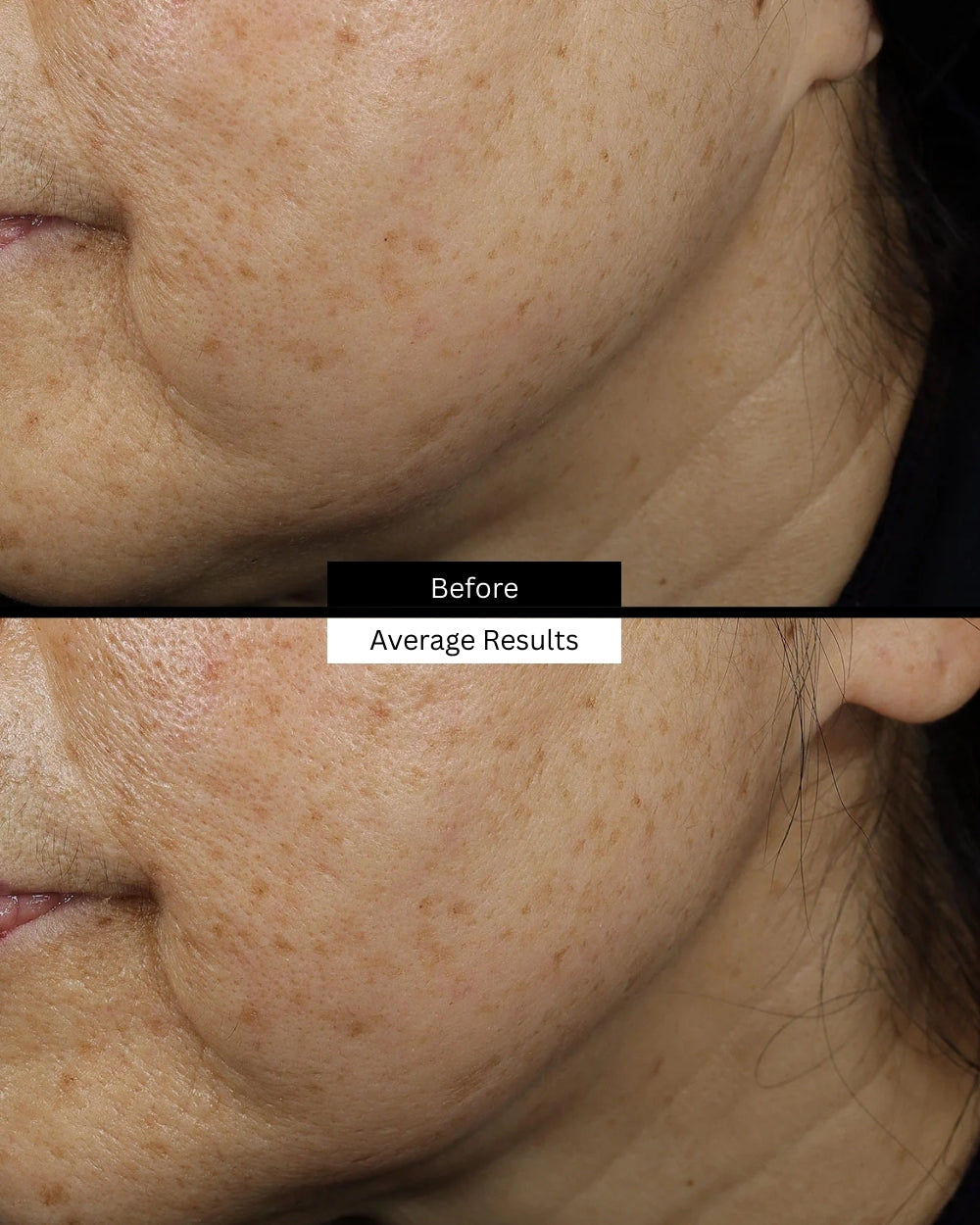 age-interrupter-serum-before-after