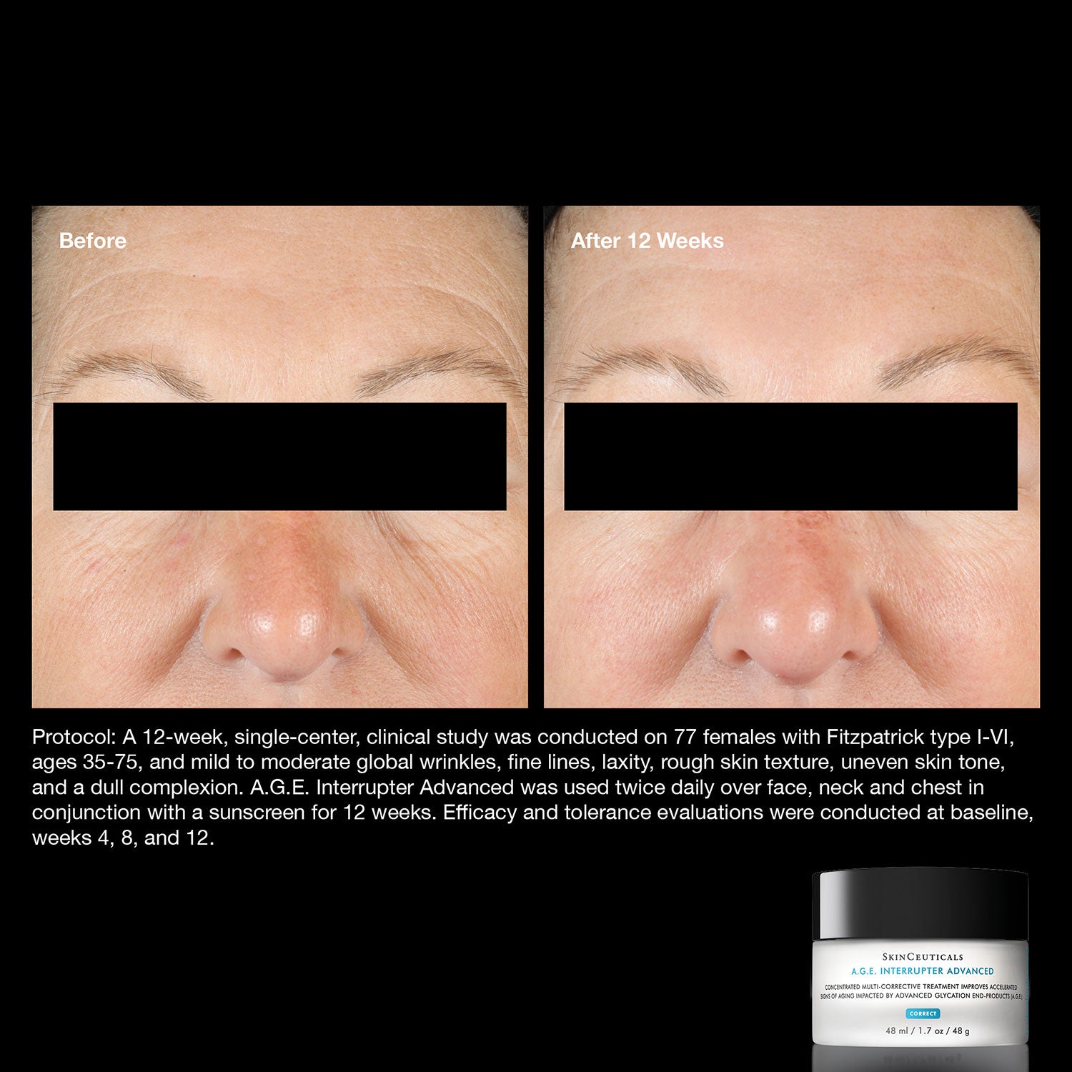 anti-aging-skin-set
