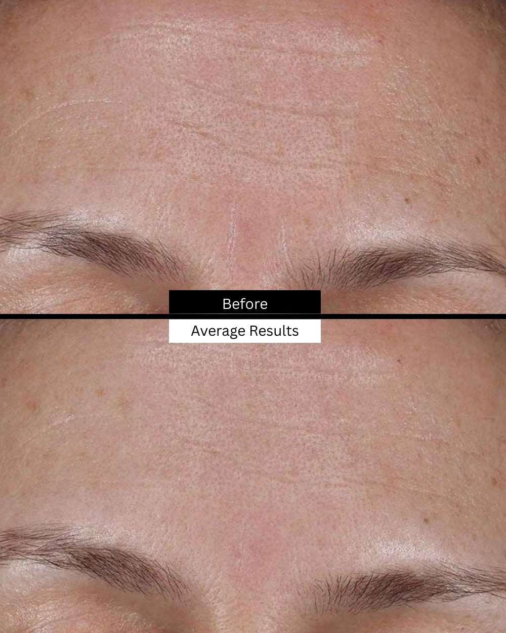 cell-cycle-catalyst-before-after