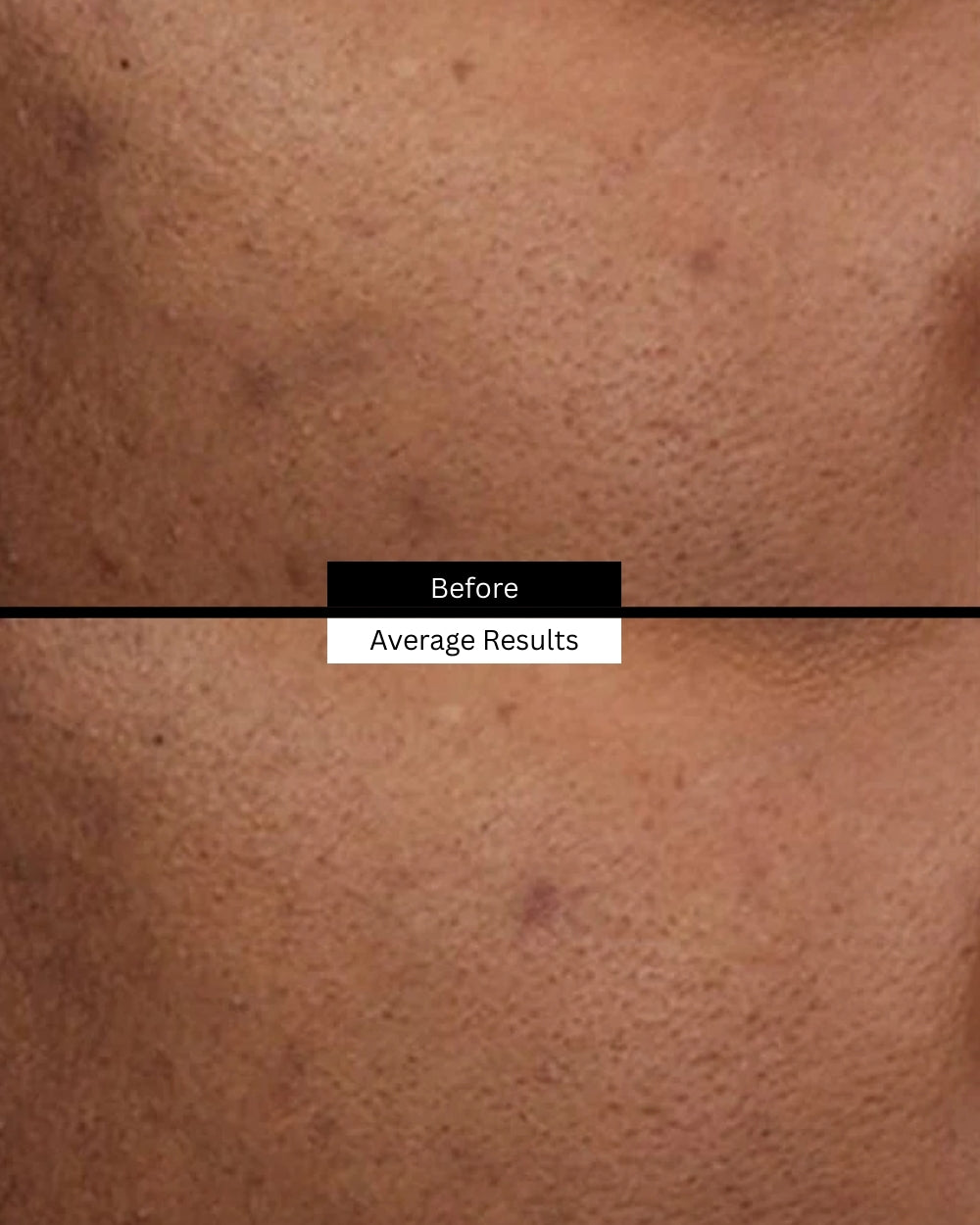 discoloration-defense-before-after
