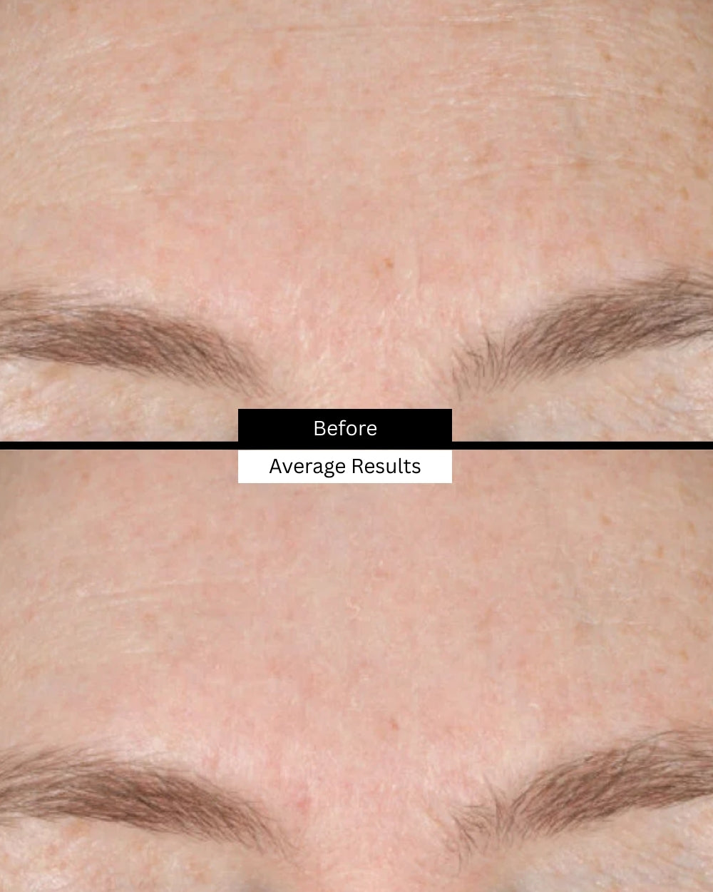 metacell-renewal-before-after