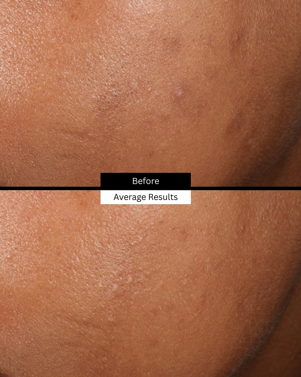 phloretin-before-after