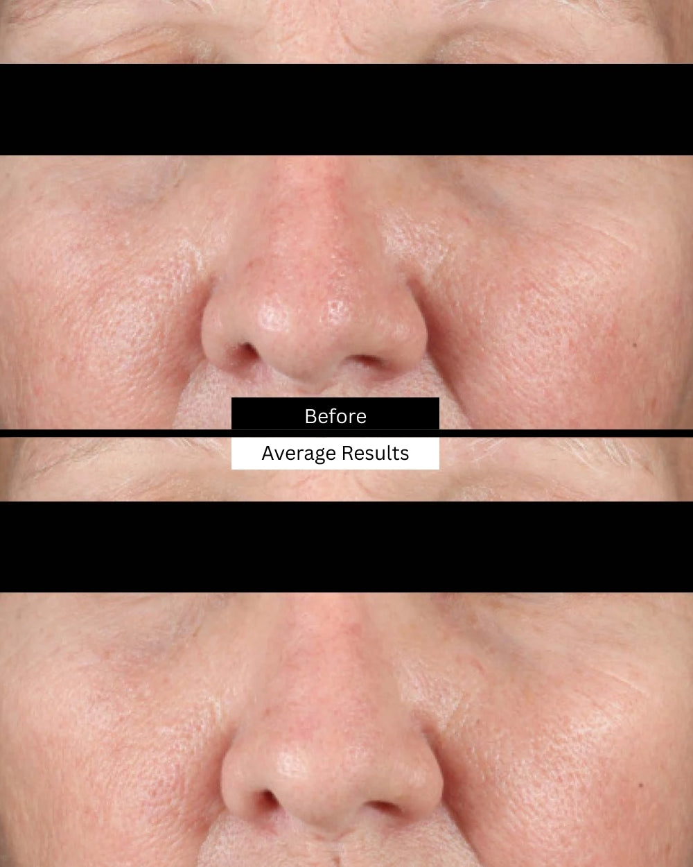 phyto-corrective-mist-before-after