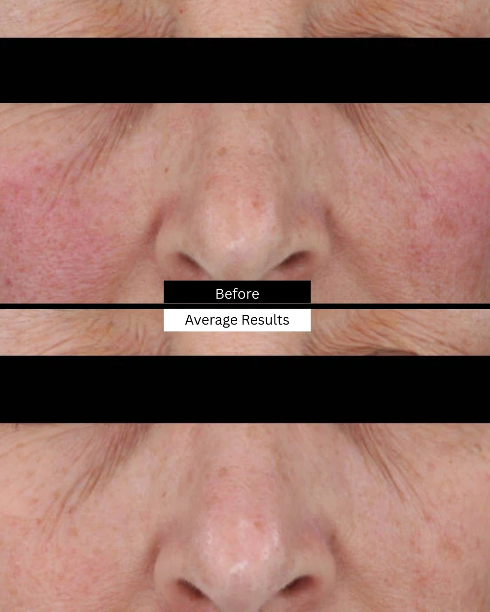 redness-neutralizer-before-after