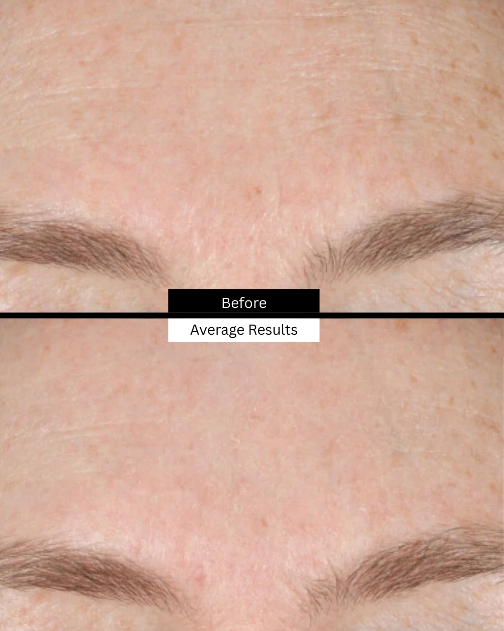 retexturing-before-after