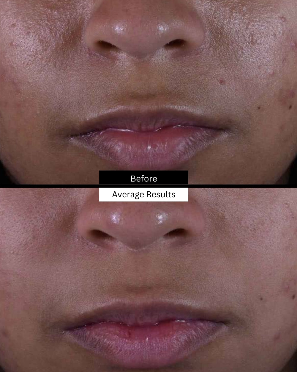 silymarin-before-after