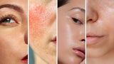 skin-type-quiz